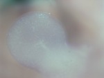 EMAGE:28572
