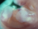 EMAGE:28583