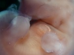 EMAGE:28606
