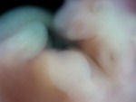 EMAGE:28610