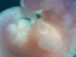 EMAGE:28622