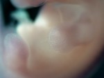 EMAGE:28651