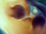 EMAGE:28702