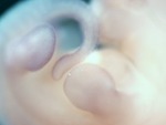 EMAGE:28702