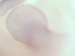 EMAGE:28702