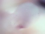 EMAGE:28709