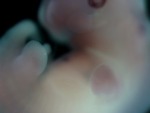 EMAGE:28762