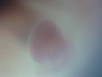 EMAGE:28762