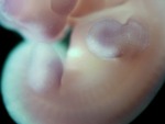 EMAGE:28777
