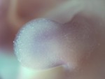 EMAGE:28777