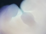 EMAGE:28784