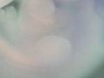 EMAGE:28794