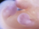 EMAGE:28860