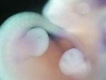 EMAGE:28877