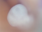 EMAGE:28877