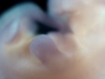 EMAGE:28913