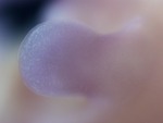EMAGE:28913