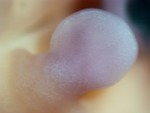 EMAGE:28925
