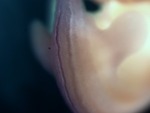 EMAGE:28941