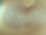 EMAGE:28941
