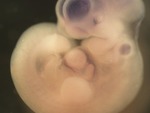 EMAGE:28946