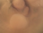 EMAGE:28946