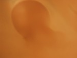 EMAGE:28974