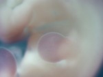 EMAGE:29051