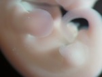 EMAGE:29054