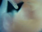 EMAGE:29067