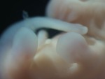 EMAGE:29067