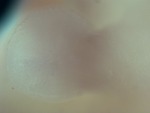 EMAGE:29067