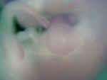 EMAGE:29092