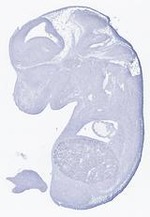 EMAGE:29202