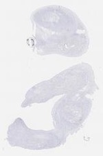 EMAGE:29204
