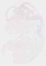 EMAGE:29249