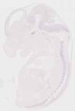 EMAGE:29249