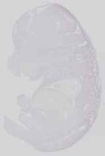 EMAGE:29251