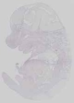 EMAGE:29256