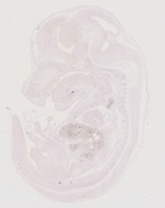 EMAGE:29263