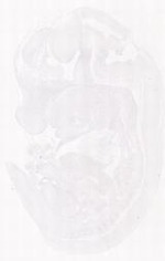 EMAGE:29266
