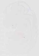 EMAGE:29276
