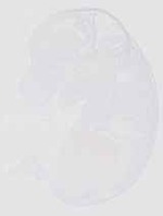 EMAGE:29276
