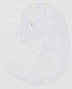 EMAGE:29276