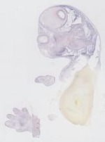 EMAGE:29278
