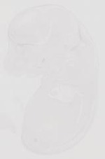 EMAGE:29333