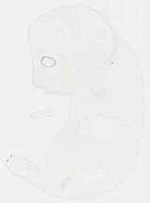 EMAGE:29339