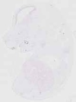 EMAGE:29349
