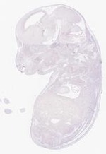 EMAGE:29352