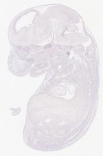 EMAGE:29352